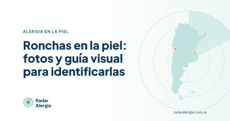 Radar Alergia: Ronchas en la piel: fotos y guía visual para identificarlas