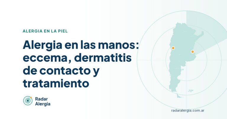 Radar Alergia: Alergia en las manos: eccema, dermatitis de contacto y tratamiento