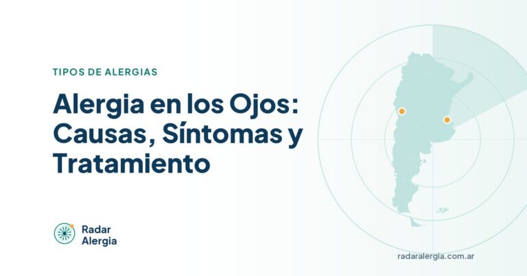 Radar Alergia: Alergia en los Ojos: Causas, Síntomas y Tratamiento