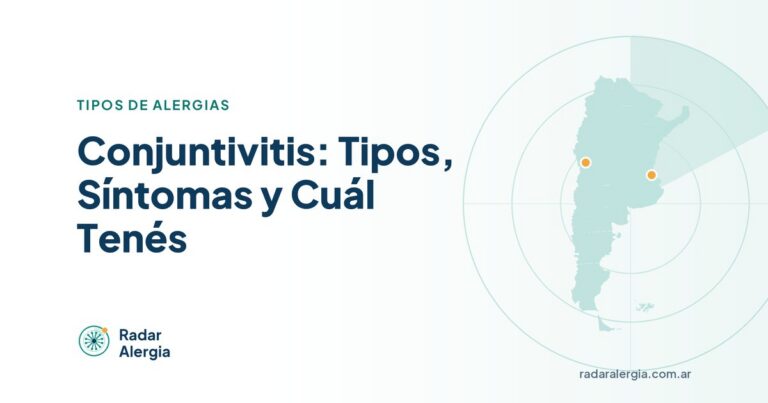 Radar Alergia: Conjuntivitis: Tipos, Síntomas y Cuál Tenés