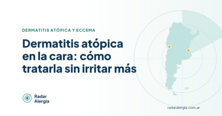Radar Alergia: Dermatitis atópica en la cara: cómo tratarla sin irritar más