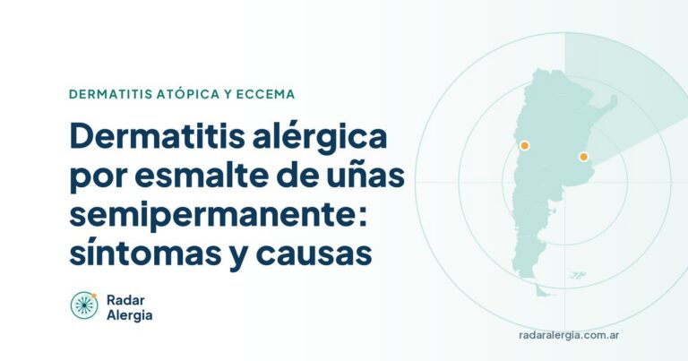 Radar Alergia: Dermatitis alérgica por esmalte de uñas semipermanente: síntomas y causas