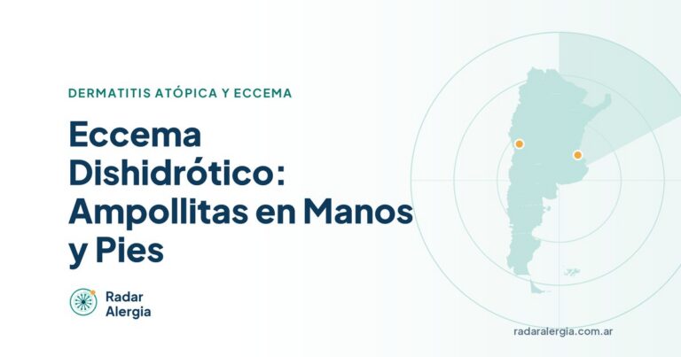 Radar Alergia: Eccema Dishidrótico: Ampollitas en Manos y Pies