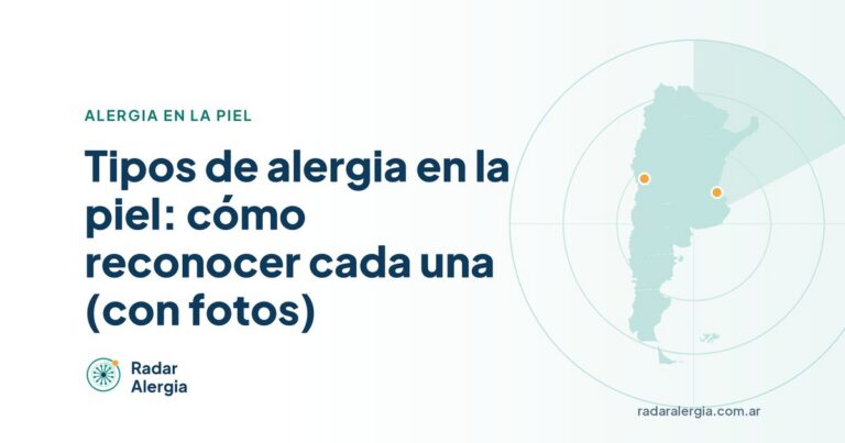 Radar Alergia: Tipos de alergia en la piel: cómo reconocer cada una (con fotos)