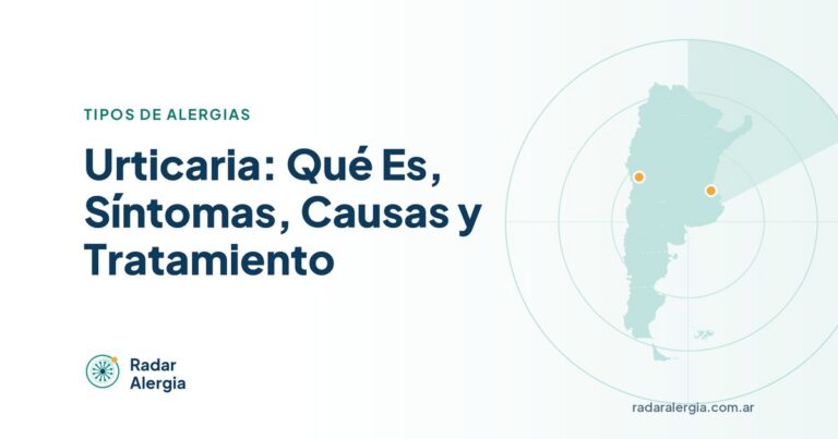 Radar Alergia: Urticaria: Qué Es, Síntomas, Causas y Tratamiento